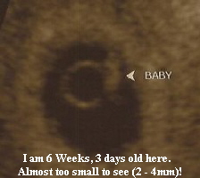 6 weeks 3 days -- 5-31-06 - small